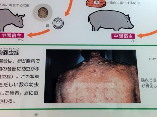 Seeing some of these pictures you really appreciate the medical and sanitation in Japan or perhaps your home country. &nbsp;Other countries are not as fortunate and have much higher rates of infestation.&nbsp;