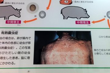 <p>Увидев некоторые из этих картинок, вы по-настоящему оцените медицину и санитарию в Японии, или возможно, в своей родной стране. Другим странам повезло меньше, в них уровень зарожения намного выше.</p>